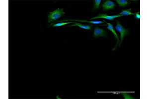 Immunofluorescence of purified MaxPab antibody to CAPN2 on HeLa cell. (Calpain 2 抗体  (AA 1-700))
