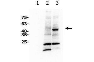 Western Blotting (WB) image for anti-Solute Carrier Family 7, (Cationic Amino Acid Transporter, Y+ System) Member 11 (SLC7A11) antibody (ABIN6655337)