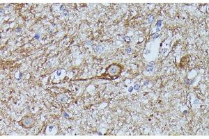 Immunohistochemistry of paraffin-embedded Mouse spinal cord using FKBP1B Polyclonal Antibody at dilution of 1:100 (40x lens). (FKBP1B 抗体)
