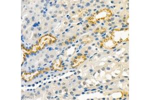 Immunohistochemistry of paraffin embedded mouse kidney using RBP (ABIN7075409) at dilution of 1: 700 (400x lens)
