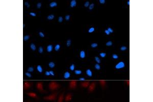 Immunofluorescence analysis of U2OS cells using PA2G4 Polyclonal Antibody (PA2G4 抗体)