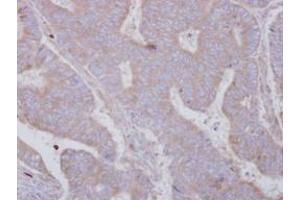 Image no. 1 for anti-SET and MYND Domain Containing 3 (SMYD3) (AA 21-416) antibody (ABIN1501007) (SMYD3 抗体  (AA 21-416))