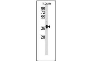 Western blot analysis of GNAO1 Antibody (C-term) Cat. (G Protein alpha 0 (AA 299-328), (C-Term) 抗体)