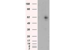 Western Blotting (WB) image for anti-Resistance To Inhibitors of Cholinesterase 8 Homolog A (C. Elegans) (RIC8A) antibody (ABIN1500704) (RIC8A 抗体)