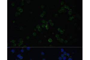Immunofluorescence analysis of Jurkat cells using CD3D Polyclonal Antibody at dilution of 1:100. (CD3D 抗体)
