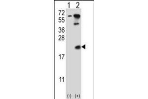 Western blot analysis of UBE2B (arrow) using rabbit polyclonal UBE2B Antibody  (ABIN388848 and ABIN2839152). (UBE2B 抗体  (C-Term))