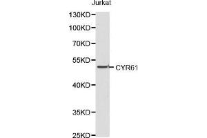 Western blot analysis of Jurkat cell lysate using CYR61 antibody. (CYR61 抗体)