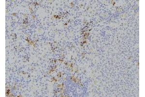 ABIN6273231 at 1/100 staining Human lymph node tissue by IHC-P. (DPP4 抗体  (C-Term))