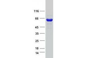 Western Blotting (WB) image for CTP Synthase II (CTPS2) (Transcript Variant 2) protein (Myc-DYKDDDDK Tag) (ABIN2712617)