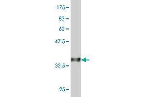 Western Blot detection against Immunogen (37 KDa) . (TRIM65 抗体  (AA 419-517))