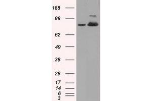 Western Blotting (WB) image for anti-Aconitase 2, Mitochondrial (ACO2) antibody (ABIN1496411)