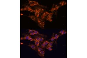 Immunofluorescence analysis of C6 cells using TMED2 antibody (ABIN7270943) at dilution of 1:100. (TMED2 抗体  (AA 60-170))