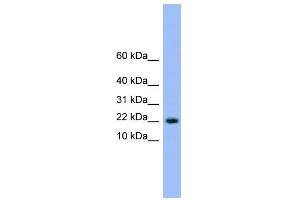 WB Suggested Anti-NXT1 Antibody Titration: 0.