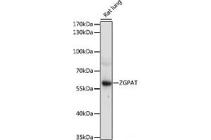 Western blot analysis of extracts of Rat lung using ZGPAT Polyclonal Antibody at dilution of 1:1000.