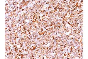 Formalin-fixed, paraffin-embedded human Tonsil stained with CD79a Mouse Monoclonal Antibody (JCB117 + HM47/A9). (CD79a 抗体  (AA 202-216))