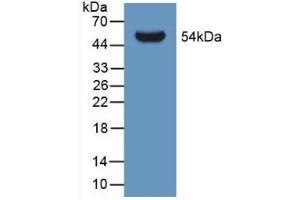 Detection of Recombinant GLTP, Human using Polyclonal Antibody to Glycolipid Transfer Protein (GLTP) (GLTP 抗体  (AA 2-209))