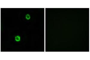 Immunofluorescence analysis of MCF-7 cells, using CST1 antibody. (CST1 抗体  (Internal Region))
