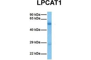 Host:  Rabbit  Target Name:  LPCAT1  Sample Tissue:  Human Ovary Tumor  Antibody Dilution:  1. (LPCAT1 抗体  (Middle Region))
