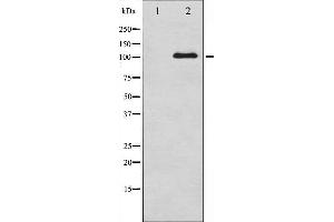 Western blot analysis of NMDAR1 phosphorylation expression in A549 whole cell lysates,The lane on the left is treated with the antigen-specific peptide. (GRIN1/NMDAR1 抗体  (pSer890))