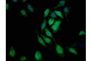 Immunofluorescent analysis of A549 cells using ABIN7161199 at dilution of 1:100 and Alexa Fluor 488-congugated AffiniPure Goat Anti-Rabbit IgG(H+L) (L1CAM 抗体  (AA 995-1119))
