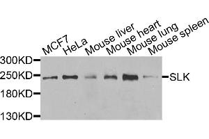 Western blot analysis of extracts of various cells, using SLK antibody. (SLK 抗体)