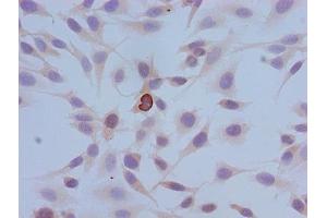 Immunocytochemistry analysis of Hela cells using ABIN7139614 at dilution of 1:100 (HIST1H3A 抗体  (pSer10))
