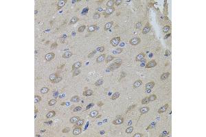 Immunohistochemistry of paraffin-embedded rat brain using SUMO3 antibody (ABIN5971585) (40x lens). (SUMO3 抗体)