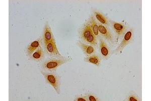 Immunocytochemistry analysis of Hela cells using ABIN7139178 at dilution of 1:100 (HIST1H2AG 抗体  (acLys36))