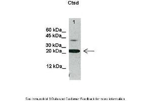 Lanes:   20 ug U937 cell lysate  Primary Antibody Dilution:   1:1000  Secondary Antibody:   Anti-rabbit HRP  Secondary Antibody Dilution:   1:2000  Gene Name:   Ctsd  Submitted by:   Ewelina Swiderek, Institute of Immunology and Experimental Therapy, Wroclaw, Poland (Cathepsin D 抗体  (C-Term))