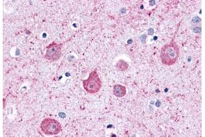 Anti-LPHN2 antibody  ABIN1049026 IHC staining of human brain, neurons and glia. (LPHN2 抗体  (C-Term))