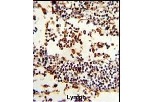 Formalin-fixed and paraffin-embedded human Lymph reacted with IGHA1 Antibody (C-term), which was peroxidase-conjugated to the secondary antibody, followed by DAB staining. (IGHA1 抗体  (C-Term))