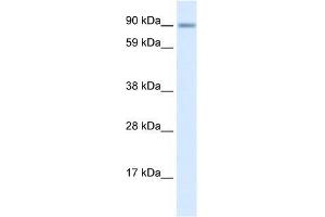Human Lung; WB Suggested Anti-ZNF537 Antibody Titration: 0. (TSHZ3 抗体  (Middle Region))