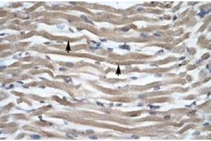 Immunohistochemical staining (Formalin-fixed paraffin-embedded sections) of human muscle with DLX2 polyclonal antibody  at 4-8 ug/mL working concentration. (DLX2 抗体  (N-Term))