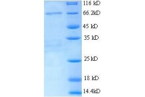 SDS-PAGE (SDS) image for alpha-Fetoprotein (AFP) (AA 19-605) protein (His tag) (ABIN5713200)