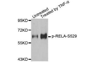 Western blot analysis of extracts from 293 cells, using Phospho-RELA-S529 antibody (ABIN2987626). (NF-kB p65 抗体  (pSer529))