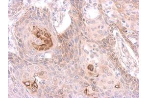IHC-P Image Immunohistochemical analysis of paraffin-embedded cal27 xenograft, using MST4 antibody, antibody at 1:500 dilution. (STK26/MST4 抗体  (Center))
