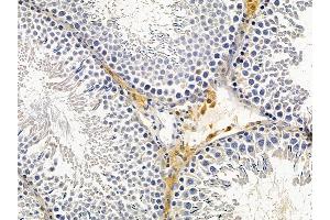 ABIN6266104 and ABIN6278813 at 1/100 staining rat testis tissue by IHC-P. (ZHX2 抗体  (C-Term))