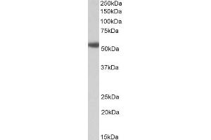 ABIN5539920 (1µg/ml) staining of Human Prostate lysate (35µg protein in RIPA buffer). (alpha 1 Adrenergic Receptor 抗体  (C-Term))