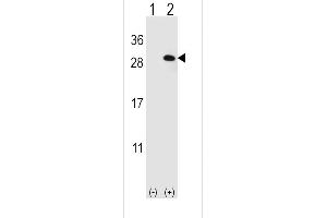 Western blot analysis of EIF4E2 using rabbit polyclonal EIF4E2 Antibody using 293 cell lysates (2 ug/lane) either nontransfected (Lane 1) or transiently transfected (Lane 2) with the EIF4E2 gene. (EIF4E2 抗体)