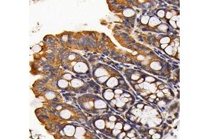 Immunohistochemistry of paraffin embedded mouse colon using RAB21 (ABIN7075341) at dilution of 1: 700 (400x lens) (RAB21 抗体)