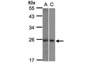 WB Image Sample(30 ug whole cell lysate) A:293T B:Hep G2 , 12% SDS PAGE antibody diluted at 1:1000 (m1ip1 抗体)
