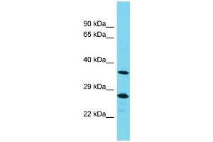 Western Blotting (WB) image for anti-Protein Tyrosine Phosphatase, Non-Receptor Type 20A (PTPN20A) (Middle Region) antibody (ABIN2791465) (PTPN20A 抗体  (Middle Region))