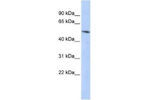 Western Blot showing BCL6B antibody used at a concentration of 1-2 ug/ml to detect its target protein. (BCL6B 抗体  (Middle Region))