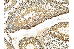ABIN6261535 and ABIN6276460 at 1/100 staining Rat testis tissue by IHC-P.
