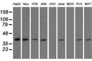 Western blot analysis of extracts (35 µg) from 9 different cell lines by using anti-HIBCH monoclonal antibody. (HIBCH 抗体)