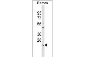 Western blot analysis in Ramos cell line lysates (35ug/lane). (LYPLA2 抗体  (C-Term))