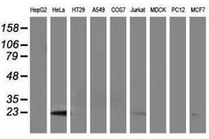 Image no. 2 for anti-Lin-7 Homolog B (LIN7B) antibody (ABIN1499156) (LIN7B 抗体)