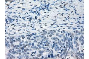 Immunohistochemical staining of paraffin-embedded colon tissue using anti-NAT8mouse monoclonal antibody. (NAT8 抗体)