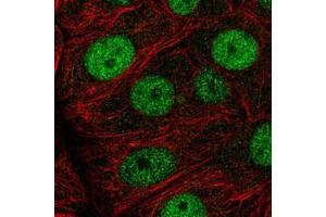 Immunofluorescent staining of MCF7 cells with MCM7 polyclonal antibody  (Green) shows positivity in nucleus but excluded from the nucleoli. (MCM7 抗体)