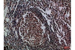 Immunohistochemical analysis of paraffin-embedded Human-tonsil, antibody was diluted at 1:100 (IL17D 抗体  (AA 141-190))